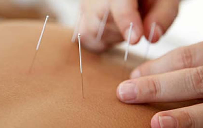 acupuncture - College Park Medical Clinic